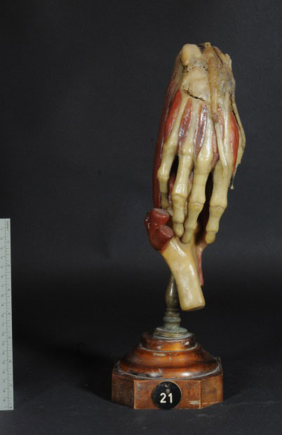 Anatomie Unterarm (mittlere Muskeln), Inv.-Nr.: AW027M