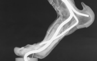 Anatomie Unterschenkel (untere Muskeln), Inv.-Nr.: AW142M; Röntgenaufnahme